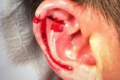Elle arrache l'oreille de sa mère avec les dents Elle arrache l'oreille de sa mère avec les dents
